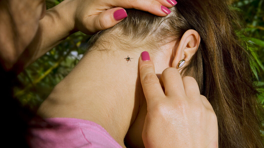 Що робити, якщо вас укусив кліщ