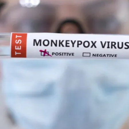 Що варто знати про вірус мавпячої віспи?